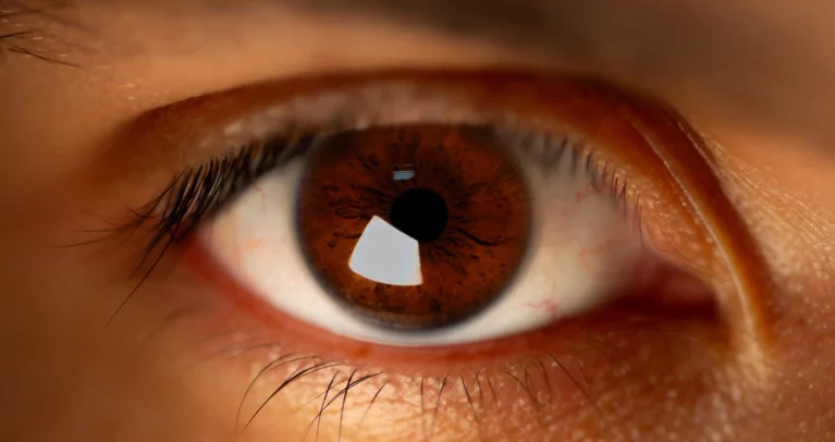 Improve eye health naturally